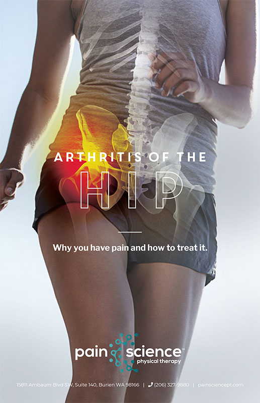 Arthritis of the Hips